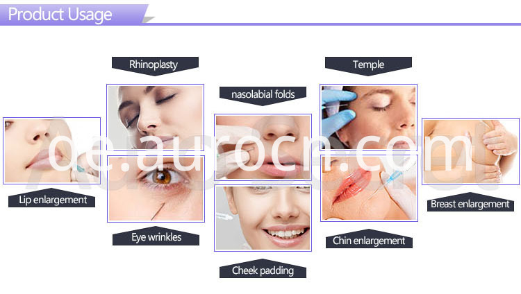 intraartikuläre Hyaluronsäure-Injektion hyaluronic acid intra-articular injection